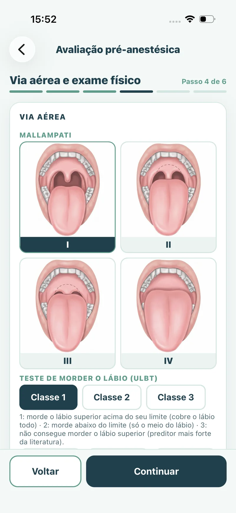 Tela do app: prancha visual de Mallampati classes I a IV e teste de morder o lábio (ULBT)